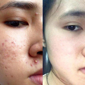 Khách hàng Ngọc Nhi đánh giá Dr Skincare