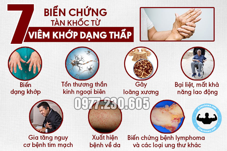 triệu chứng đau nhức xương khớp