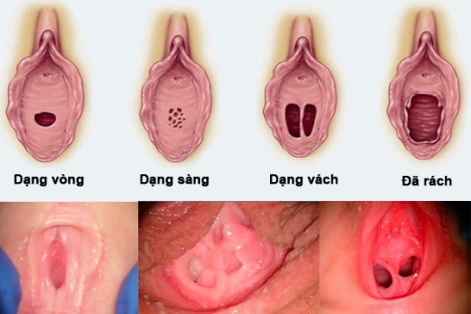 Cấu tạo lồn gái còn trinh mới lớn