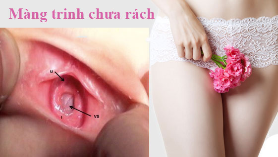 Hình ảnh mu lồn gái trinh mới lớn