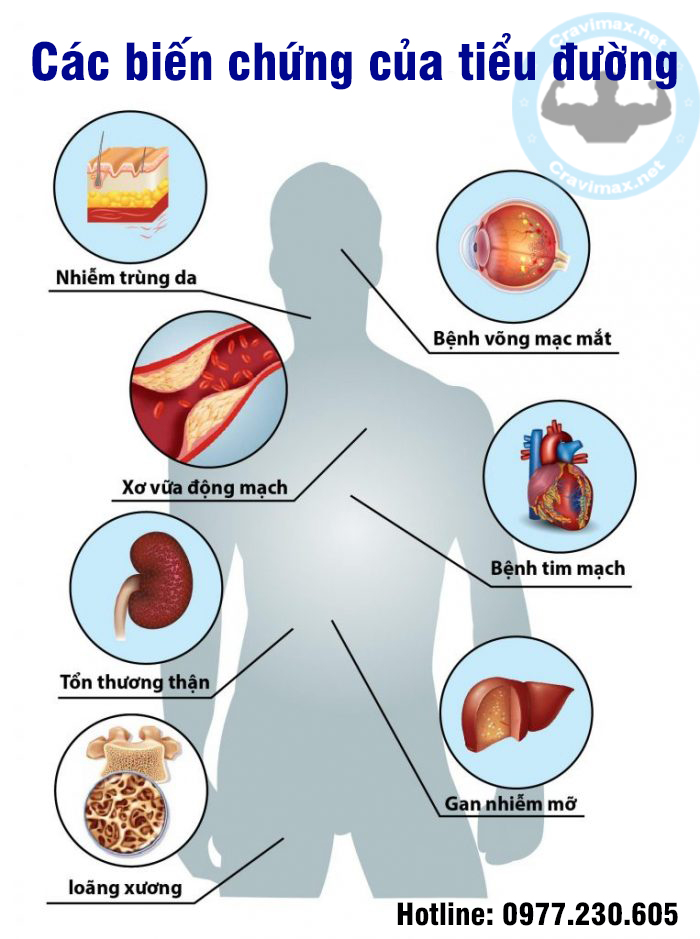 các biến chứng của bệnh tiểu đường gây ra