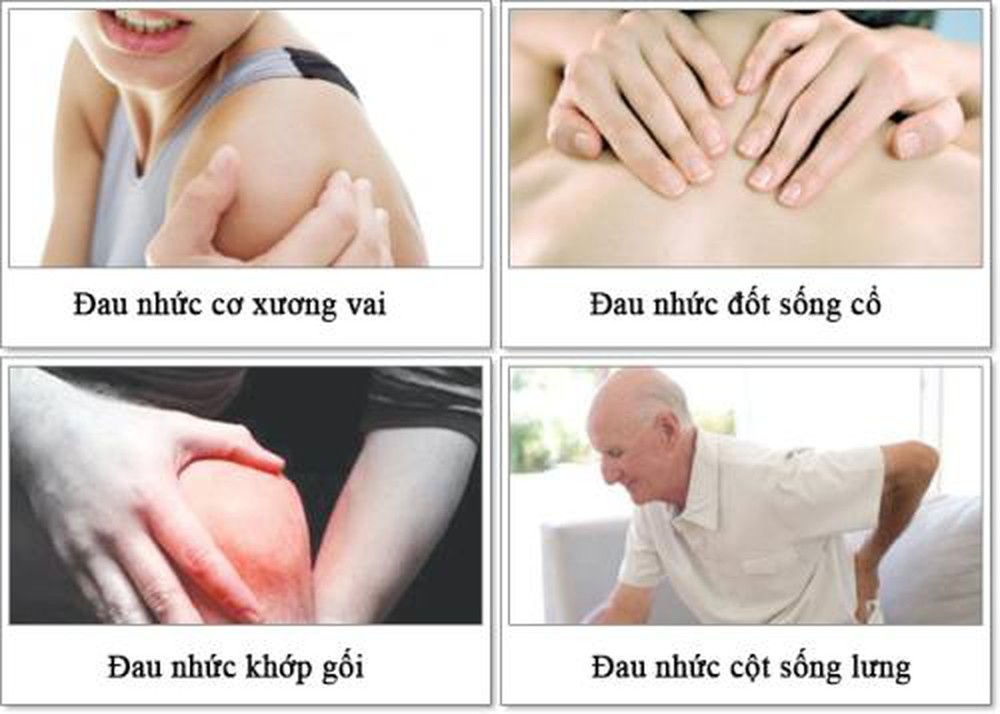 các biểu hiện đau nhức xương khớp