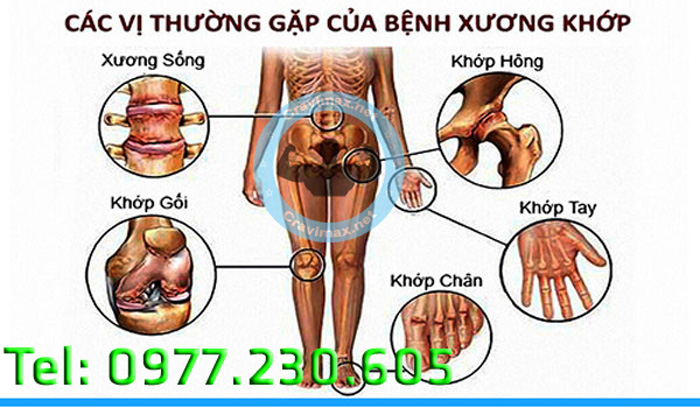 Nguyên nhân Khớp Khang Thọ