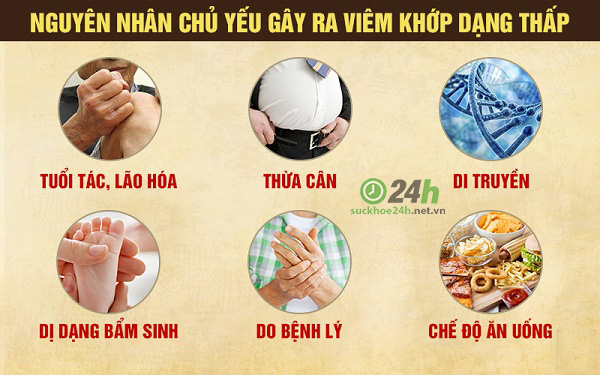 Nguyên nhân đau xương khớp