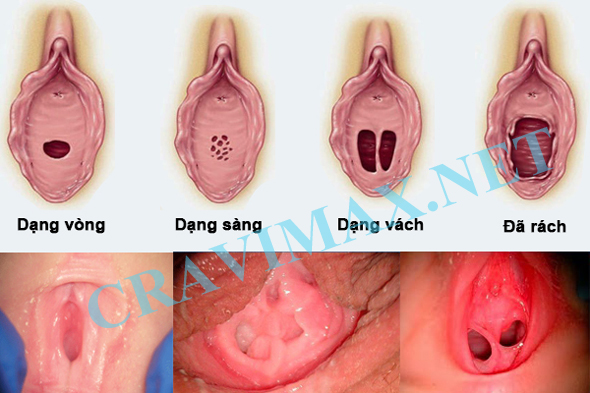 cach-nhan-biet-gai-con-trinh-1